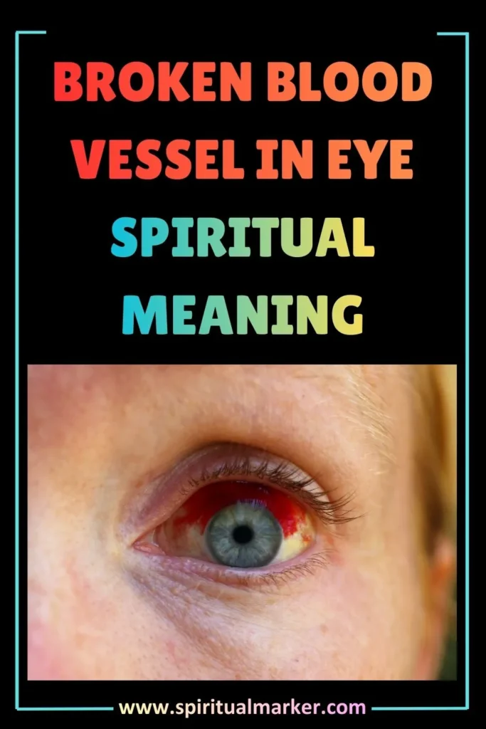 broken-blood-vessel-in-the-eye-spiritual-meaning-myths