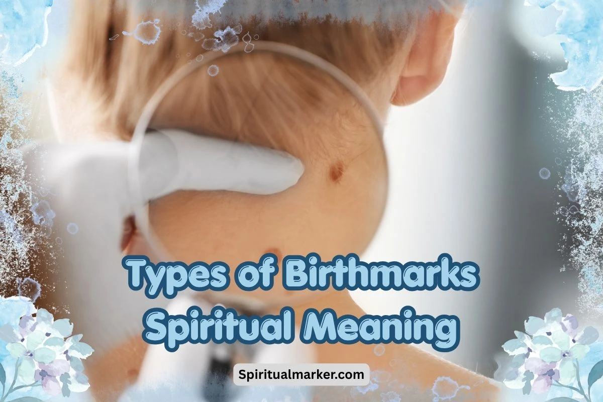 Irthmarks Meanings of Birthmarks – Types, Shapes, Locations & Colors | Spiritual ...